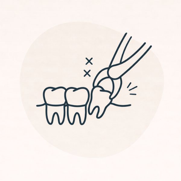 fjernelse af visdomstand